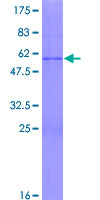 RHOXF1 Protein - 12.5% SDS-PAGE of human RHOXF1 stained with Coomassie Blue
