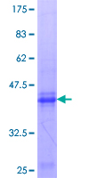 RHOXF1 Protein - 12.5% SDS-PAGE Stained with Coomassie Blue.