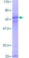 RHOXF2 Protein - 12.5% SDS-PAGE of human PEPP-2 stained with Coomassie Blue