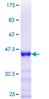 RHOXF2 Protein - 12.5% SDS-PAGE Stained with Coomassie Blue.