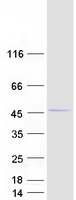 RHOXF2 Protein - Purified recombinant protein RHOXF2 was analyzed by SDS-PAGE gel and Coomassie Blue Staining
