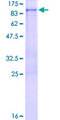 RHPN1 / RHOPHILIN Protein - 12.5% SDS-PAGE of human RHPN1 stained with Coomassie Blue