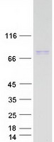 RHPN1 / RHOPHILIN Protein - Purified recombinant protein RHPN1 was analyzed by SDS-PAGE gel and Coomassie Blue Staining
