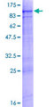 RHPN2 Protein - 12.5% SDS-PAGE of human RHPN2 stained with Coomassie Blue
