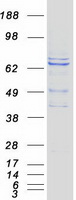 RHPN2 Protein - Purified recombinant protein RHPN2 was analyzed by SDS-PAGE gel and Coomassie Blue Staining