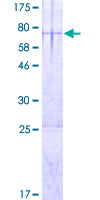 RIBC1 Protein - 12.5% SDS-PAGE of human RIBC1 stained with Coomassie Blue