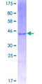Ribonuclease A / RNASE1 Protein - 12.5% SDS-PAGE of human RNASE1 stained with Coomassie Blue