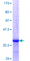 Ribonuclease A / RNASE1 Protein - 12.5% SDS-PAGE Stained with Coomassie Blue.