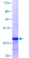 Ribonuclease A / RNASE1 Protein - 12.5% SDS-PAGE Stained with Coomassie Blue.