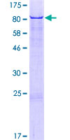 RIC3 Protein - 12.5% SDS-PAGE of human RIC3 stained with Coomassie Blue
