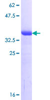 RIC8A Protein - 12.5% SDS-PAGE Stained with Coomassie Blue.