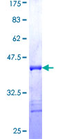 RICK / RIP2 Protein - 12.5% SDS-PAGE Stained with Coomassie Blue.