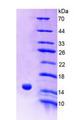 RICK / RIP2 Protein - Recombinant Receptor Interacting Serine Threonine Kinase 2 By SDS-PAGE