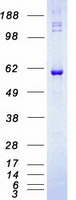 RICK / RIP2 Protein - Purified recombinant protein RIPK2 was analyzed by SDS-PAGE gel and Coomassie Blue Staining