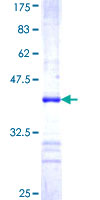 RICTOR Protein - 12.5% SDS-PAGE Stained with Coomassie Blue.