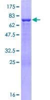 RILPL1 Protein - 12.5% SDS-PAGE of human RILPL1 stained with Coomassie Blue