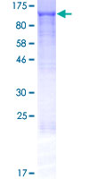 RIMBP3 Protein - 12.5% SDS-PAGE of human RIMBP3 stained with Coomassie Blue