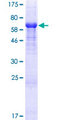 RIMKLA Protein - 12.5% SDS-PAGE of human FAM80A stained with Coomassie Blue