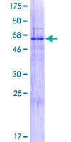 RIMKLB Protein - 12.5% SDS-PAGE of human FAM80B stained with Coomassie Blue