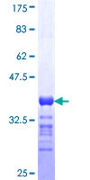 RIMS2 / RIM2 Protein - 12.5% SDS-PAGE Stained with Coomassie Blue.