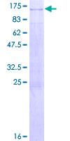 RIN1 Protein - 12.5% SDS-PAGE of human RIN1 stained with Coomassie Blue