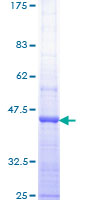 RIN1 Protein - 12.5% SDS-PAGE Stained with Coomassie Blue.