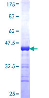 RIN3 Protein - 12.5% SDS-PAGE Stained with Coomassie Blue.