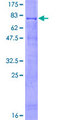 RING1 Protein - 12.5% SDS-PAGE of human RING1 stained with Coomassie Blue