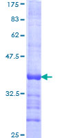 RING1 Protein - 12.5% SDS-PAGE Stained with Coomassie Blue.
