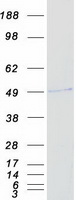 RING1 Protein - Purified recombinant protein RING1 was analyzed by SDS-PAGE gel and Coomassie Blue Staining