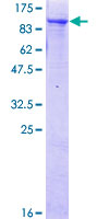 RINT1 Protein - 12.5% SDS-PAGE of human RINT1 stained with Coomassie Blue