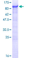 RIOK1 Protein - 12.5% SDS-PAGE of human RIOK1 stained with Coomassie Blue