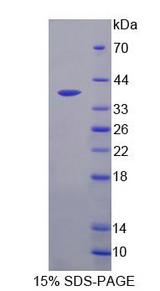 RIOK1 Protein - Recombinant  RIO Kinase 1 By SDS-PAGE