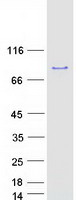 RIOK1 Protein - Purified recombinant protein RIOK1 was analyzed by SDS-PAGE gel and Coomassie Blue Staining