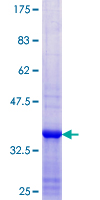 RIOK2 Protein - 12.5% SDS-PAGE Stained with Coomassie Blue.