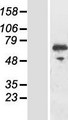 RIOK3 Protein - Western validation with an anti-DDK antibody * L: Control HEK293 lysate R: Over-expression lysate