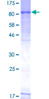 RIOK3 Protein - 12.5% SDS-PAGE of human RIOK3 stained with Coomassie Blue