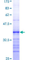 RIOK3 Protein - 12.5% SDS-PAGE Stained with Coomassie Blue.