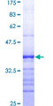 RIOK3 Protein - 12.5% SDS-PAGE Stained with Coomassie Blue.
