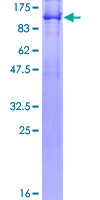RIP1 / RALBP1 Protein - 12.5% SDS-PAGE of human RALBP1 stained with Coomassie Blue