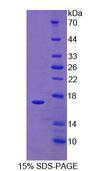 RIP1 / RALBP1 Protein - Recombinant RalA Binding Protein 1 By SDS-PAGE