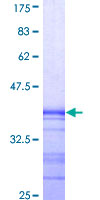 RIP4 / ANKRD3 Protein - 12.5% SDS-PAGE Stained with Coomassie Blue