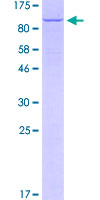 RIPK1 / RIP Protein - 12.5% SDS-PAGE of human RIPK1 stained with Coomassie Blue