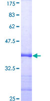 RIPK1 / RIP Protein - 12.5% SDS-PAGE Stained with Coomassie Blue.