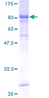 RIPK3 / RIP3 Protein - 12.5% SDS-PAGE of human RIPK3 stained with Coomassie Blue