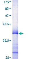 RIPK3 / RIP3 Protein - 12.5% SDS-PAGE Stained with Coomassie Blue.