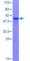 RIPPLY3 / DSCR6 Protein - 12.5% SDS-PAGE of human DSCR6 stained with Coomassie Blue