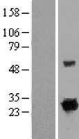 RIT1 Protein - Western validation with an anti-DDK antibody * L: Control HEK293 lysate R: Over-expression lysate