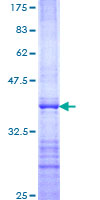 RIT1 Protein - 12.5% SDS-PAGE Stained with Coomassie Blue.