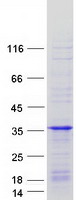 RIT1 Protein - Purified recombinant protein RIT1 was analyzed by SDS-PAGE gel and Coomassie Blue Staining